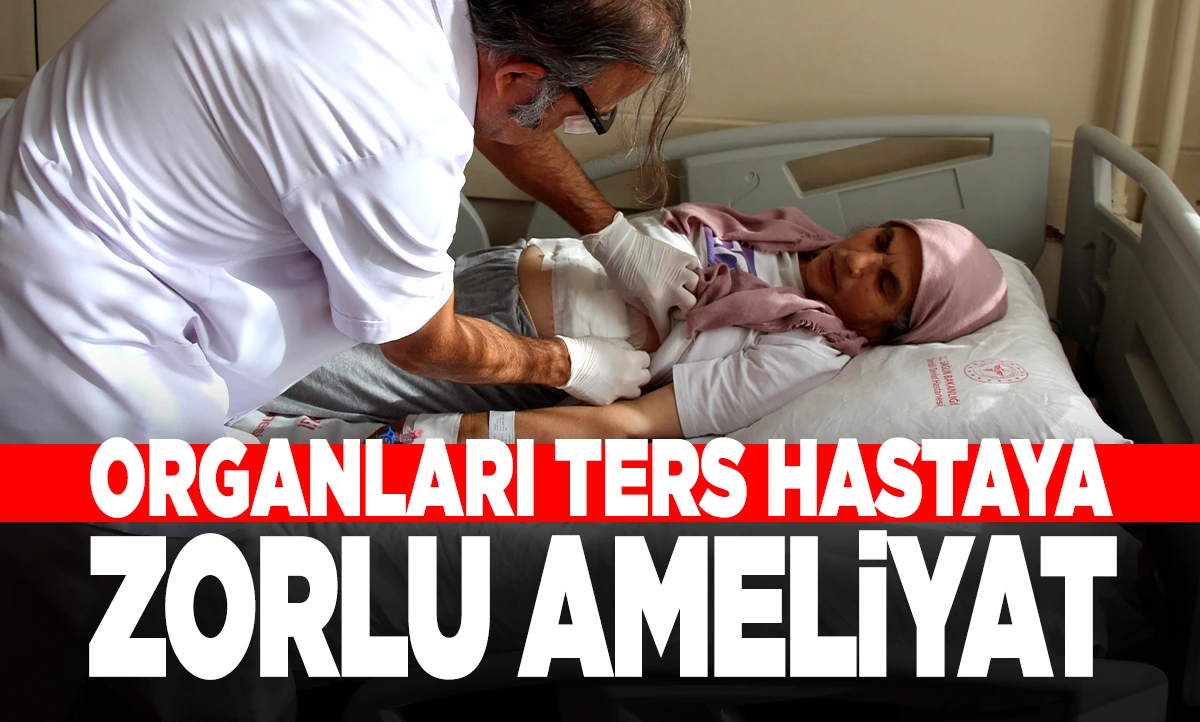 &ldquo;Organları Ters Yerleşimli Hastaya Zorlu Ameliyat: Doktorlar Başardı&rdquo;