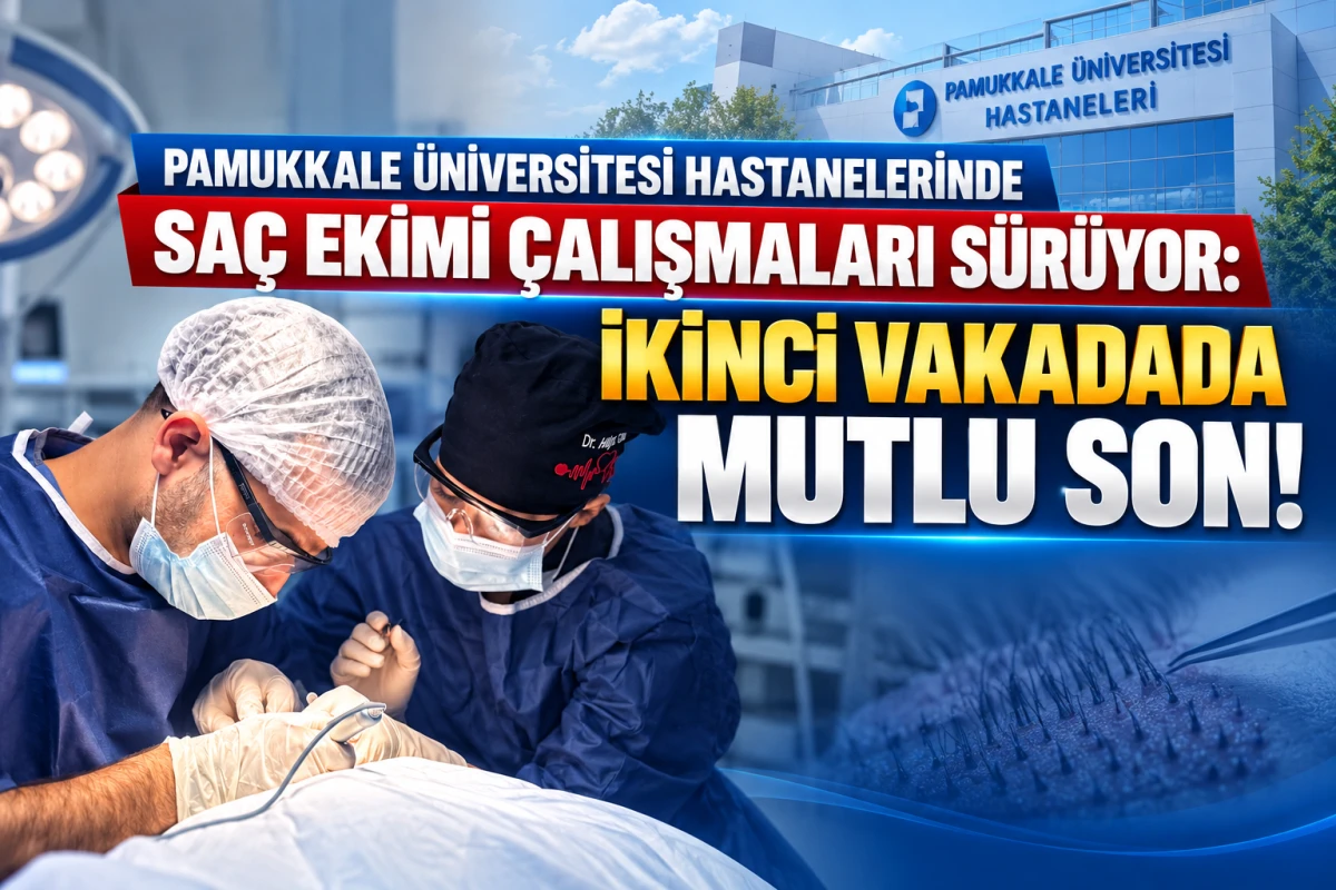 PA&Uuml; Hastaneleri Sa&ccedil; Ekimi &Uuml;nitesinde Başarılı Operasyon: Skarlı Alopesi Hastasına 600 Greft Nakledildi!